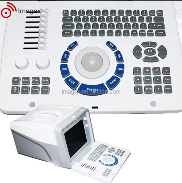 Portable Ultrasound Diagnostic Machine for Obstetrics and Gynecology - Image 3