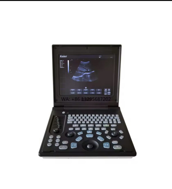Laptop 3D/4D Color Doppler Ultrasound Machine  for Obstetrics & Gynecology Applications Ultrasound Scanner - Image 2