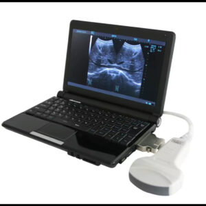 Laptop 3D/4D Color Doppler Ultrasound Machine  for Obstetrics & Gynecology Applications Ultrasound Scanner