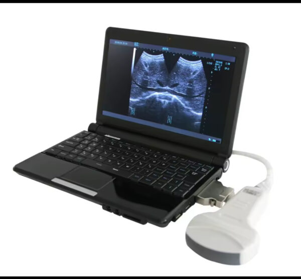 Laptop 3D/4D Color Doppler Ultrasound Machine  for Obstetrics & Gynecology Applications Ultrasound Scanner