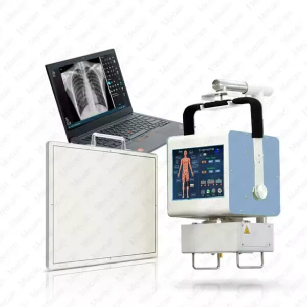 X-ray DR 5kw mobile  machine, medical portable digital  machine - Image 5