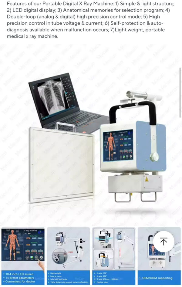 X-ray DR 5kw mobile  machine, medical portable digital  machine - Image 7