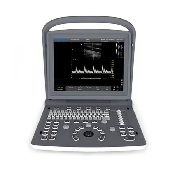 Professional Ultrasound Imaging Device - Image 2